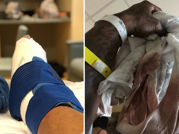 Lil Scrappy got into a car accident.